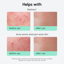 Redness Soothing Azelaic Acid Serum