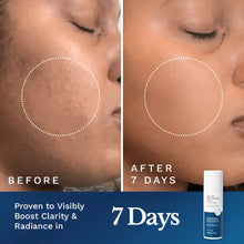 Clear Out Skin Clarifying Cream